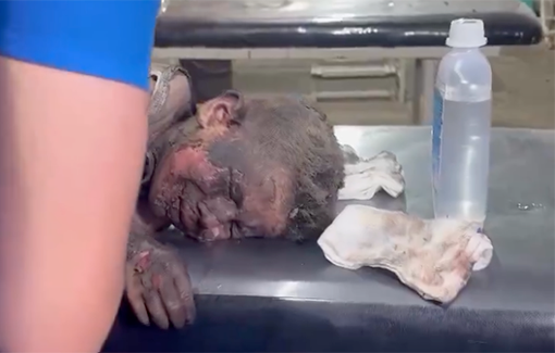 Thumbnail image of a video tagged with Kuwait Specialty Hospital