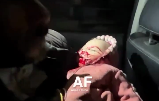 Thumbnail preview image for the video titled: Baby girl critically injured being rushed to hospital