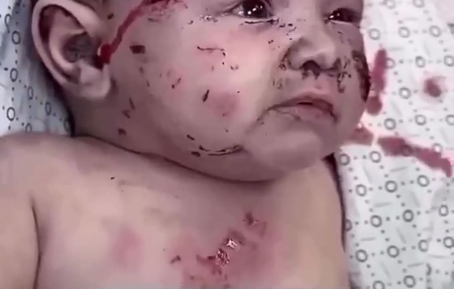 Thumbnail preview image for the video titled: Injured batered baby