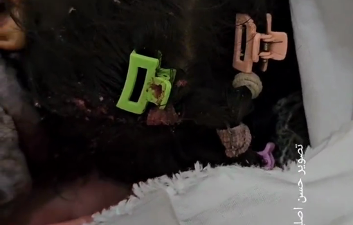 Thumbnail preview image for the video titled: Little girl killed in Israeli airstrike on Al-Bardawil family's tent in Al-Mawasi