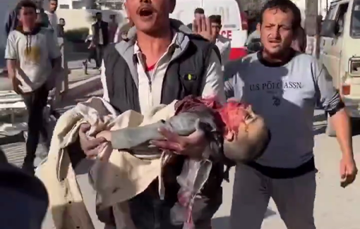 Thumbnail preview image for the video titled: Child gruesomely killed in Israeli bombing on Eid day