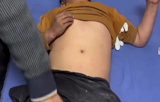 Thumbnail preview image for the video titled: Child wounded by israeli artillery shelling in Jabalia