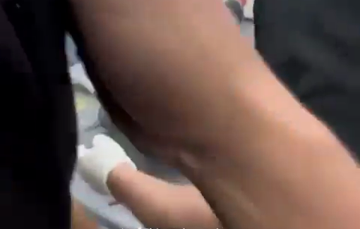 Thumbnail preview image for the video titled: Journalist Hassan Eslayeh wounded in direct Israeli airstrike