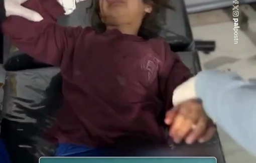 Thumbnail preview image for the video titled: Children injured by Israeli night strikes in Khan Younis