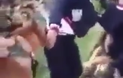 Thumbnail preview image for the video titled: IDF set two dogs to maul Palestinian child