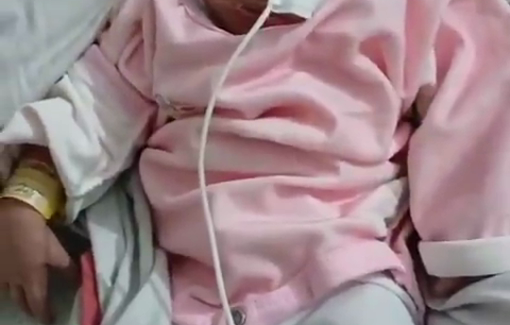 Thumbnail preview image for the video titled: Baby Malak born without a brain in Gaza