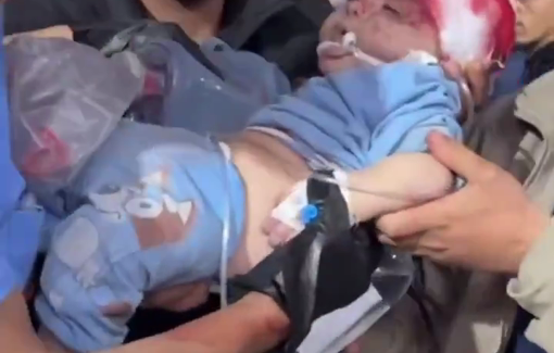 Thumbnail preview image for the video titled: Infants injured in Israeli bombing of Abu Hamisa school