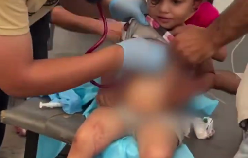 Thumbnail preview image for the video titled: Children injured in Israeli strike on a public gathering in Al-Zaytoun neighborhood