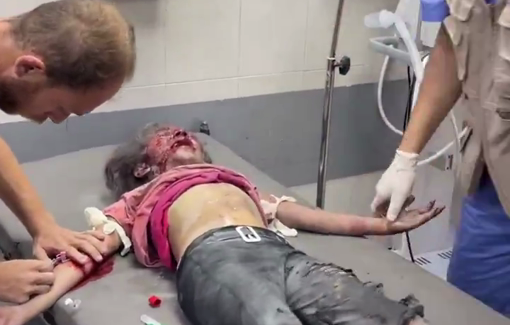 Thumbnail preview image for the video titled: Wound child screams in pain and calls for her dad