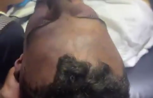 Thumbnail preview image for the video titled: A second lynched Palestinian, Muhammad Awad found after being missing for hours in Sinjil