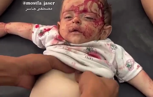 Thumbnail preview image for the video titled: Desperate attempt to resuscitate an injured infant