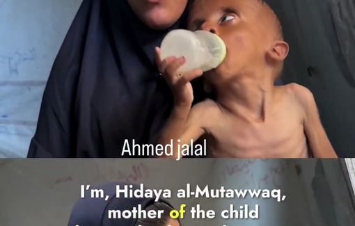 Thumbnail preview image for the video titled: Mohammad Zakaria Al-Mutawwaq, just one and a half years old, is suffering from severe toxic malnutrition