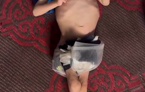 Thumbnail preview image for the video titled: Manufactured starvation has left a mother and her six children all suffering from severe malnutrition