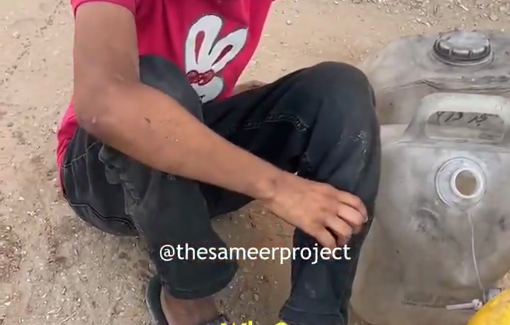 Thumbnail preview image for the video titled: Starved little girl cries as she's unable to keep standing in a water queue