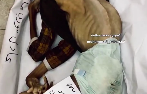 Thumbnail preview image for the video titled: Young Adel Madi killed by Israel's food and medication blockade