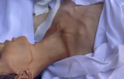 Thumbnail preview image for the video titled: 17y/o Atef Abu Khater killed by Israel's starvation policy