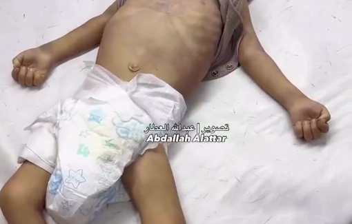 Thumbnail preview image for the video titled: Infant Mohammad Zakaria Asfour killed by Israel's starvation policy