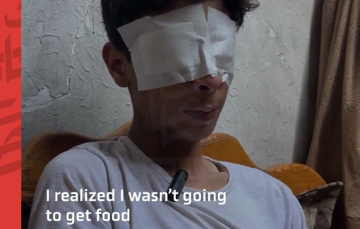 Thumbnail preview image for the video titled: Teen Palestinian witnessed massacres at GHF site, shot and blinded