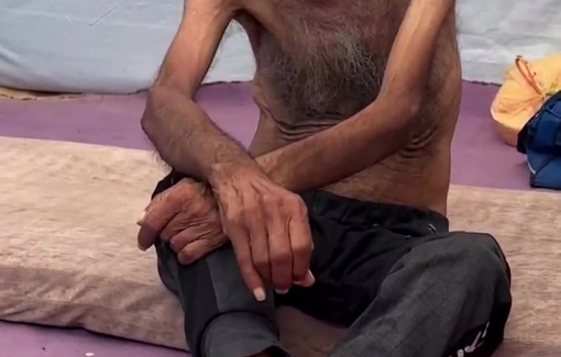 Thumbnail preview image for the video titled: 75 y/o Hasan Abu Sabla suffers from malnutrition due to Israel's starvation policy