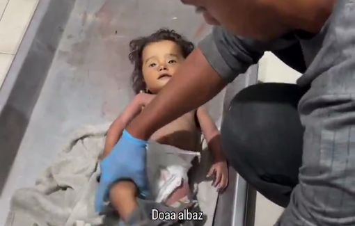 Thumbnail preview image for the video titled: Infant Aysel al-Arja dies from malnutrition due to Israel's continuous blockade