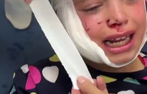 Thumbnail preview image for the video titled: An Israeli drone strike targeted a displaced persons’ tent in the Al-Mawasi