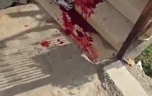 Thumbnail preview image for the video titled: A young Palestinian man, Khaled al-Fasfous, was abducted by Israeli forces after being shot.