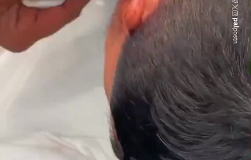 Thumbnail preview image for the video titled: The father of child Moatasem Al-Sharafi breaks down in tears during a final look at his son