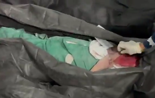 Thumbnail preview image for the video titled: The Israeli and Us airstikes on the elementary school in Minab massacred 108 little girls