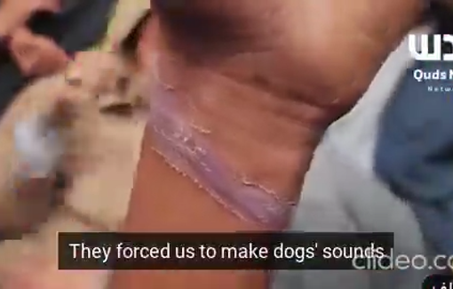 Thumbnail preview image for the video titled: Narcotic pills, beating, electric shocks, starvation... released Gaza residents share harrowing accounts of Israeli forces' brutal torture.