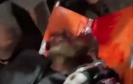 Thumbnail preview image for the video titled: Young man beheaded by Israeli airstrike on Palestinians in Gaza, killing 5 people